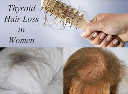 hairloss inset