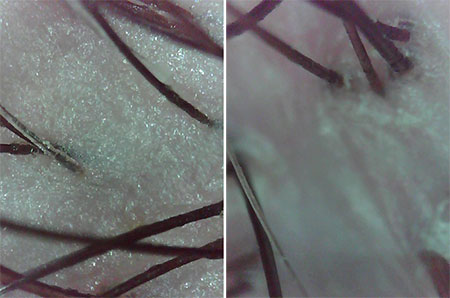 nioxin3